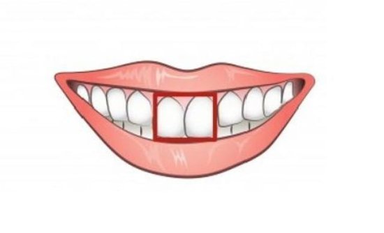 心理测试：你的门牙是哪种？<em>测你人生中</em>到底有没有财运！