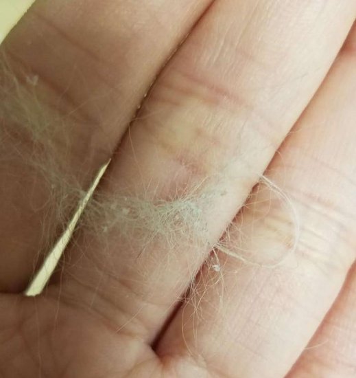 猫一梳毛能<em>梳下来</em>很多皮屑，是有皮肤病吗？