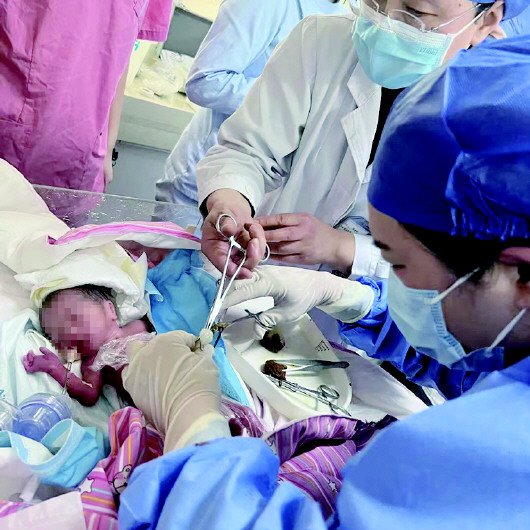 山东省中医院成功接生26周超早产双胞胎