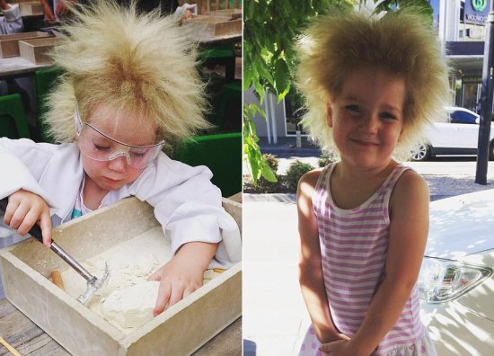 澳大利亚10岁女孩患难<em>梳头发</em>综合征 与爱因斯坦同发型