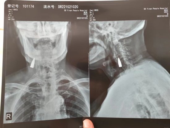 临沂95岁抗战老兵就医发现颈部有子弹，女婿：身体状况良好，不...