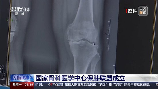 首批28家<em>三甲医院</em>！国家骨科医学中心保膝联盟成立