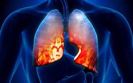 肺癌<em>对人体</em>到底都有哪些危害，为什么手指粗皮肤痒都能和肺癌...