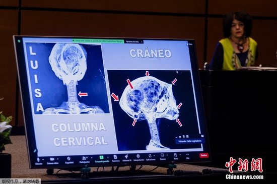 墨西哥展示疑似“外星人”遗骸X光片 称其为非人类<em>干尸</em>曾是活物