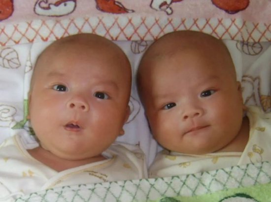 真的好幸运，居然喜得两枚“小少爷”，说说怀双胞胎孕期出现...