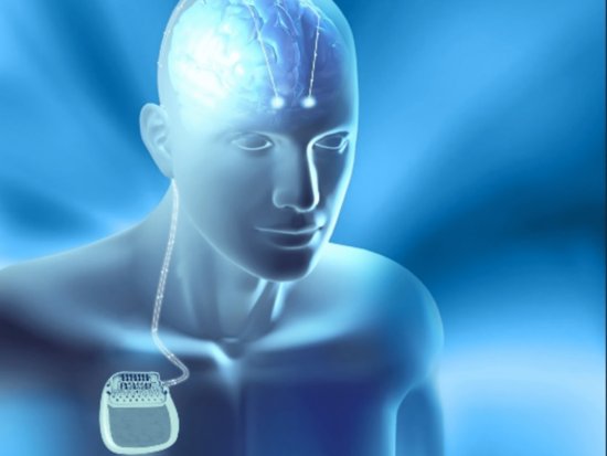 2021进博会｜全球首款具备感知技术的脑起搏器亮相进博会，预计...