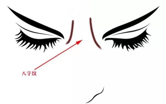 眉间竖纹代表什么，男女有区别，如何治疗？