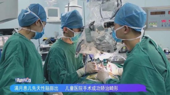 满月患儿先天性脑膨出 徐州市儿童医院手术成功矫治畸形