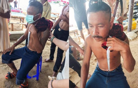 泰国35岁男子<em>海边游泳</em>被受惊腭针鱼刺进脖子