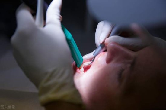 <em>为什么</em>中国牙医拔牙和种牙很厉害，但<em>牙周</em>炎就是治不<em>好</em>？